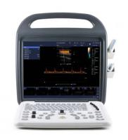 Бездротовий УЗД датчик конвексний 3.5MHz Kaixin BIOSCAN-W1, BIOSCAN-W1